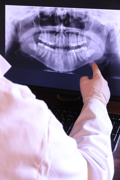 Best Emergency Root Canal Treatment in High Bridge, WA